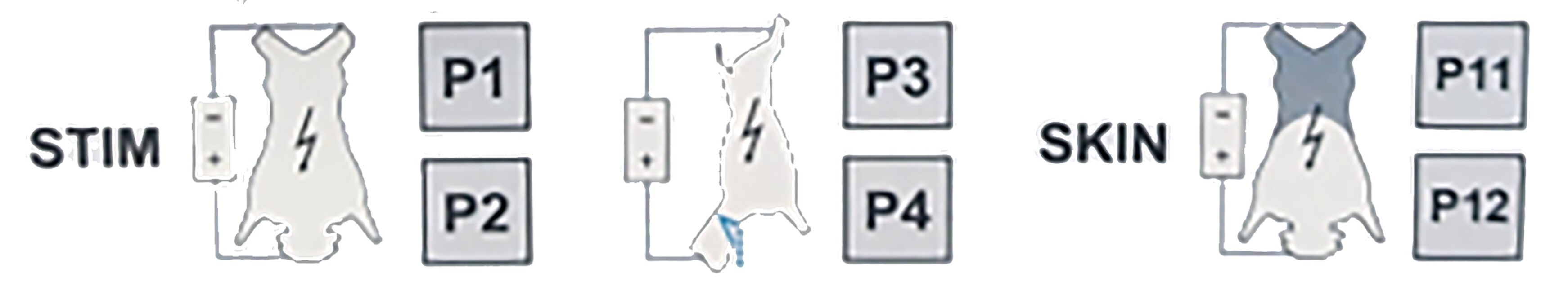 Immobilize, Stimulator and Stiffen Immobilize, Stimulator and Stiffen